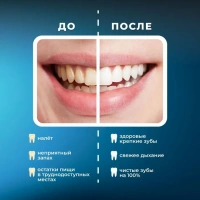 Портативный ирригатор для полости рта MIRU BIP-005, белый